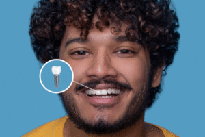 How Long Do Dental Implants Last